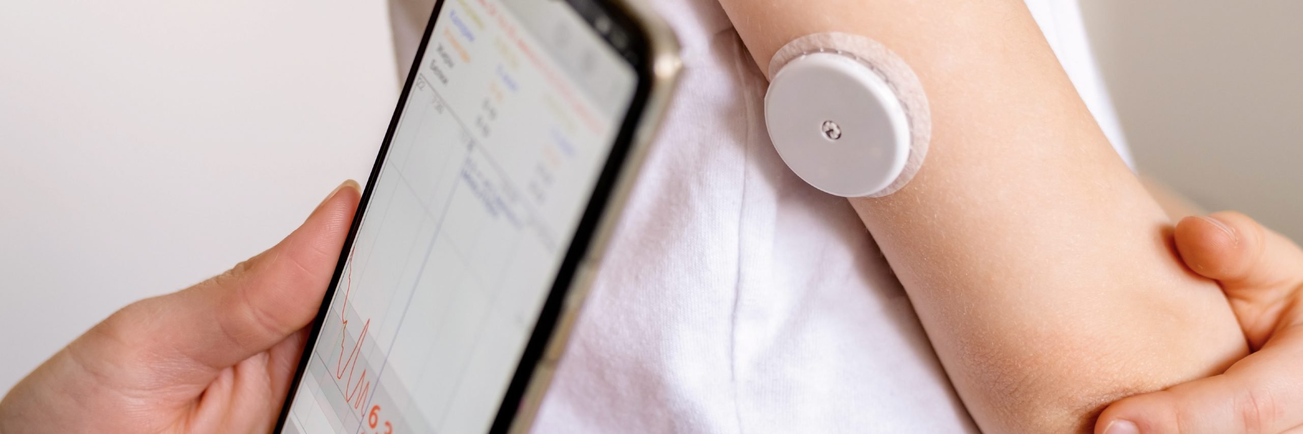Continuous blood sugar monitors what do they tell us? And what not?
